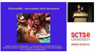 Paravalvular leak transoesophageal echocardiography [upl. by Alletse]