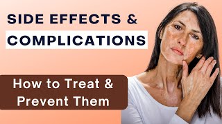 Long Term Delayed Side Effects of a Chemical Peel [upl. by Candra]