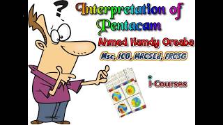 Pentacam Interpretation English [upl. by Jariv]