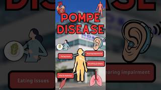 Pompe Disease glycogen facts didyouknow muscle medical videos fyp fy fypシ゚ science [upl. by Nonac]