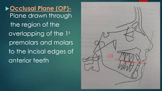 Cephalometric Planes [upl. by Aihsi420]