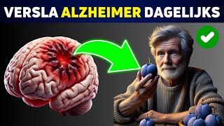 De 7 Beste Dagelijkse Gewoonten om Je Hersenen tegen Alzheimer te Beschermen [upl. by Conrade]