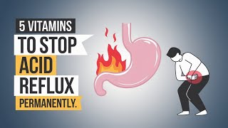 Top 5 Vitamins and Minerals That Permanently Cure Acid Reflux  Healthy Natural Remedies [upl. by Imat]