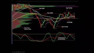 Learn the 1Minute Trade Setup  Easy Emini Trade [upl. by Colier]