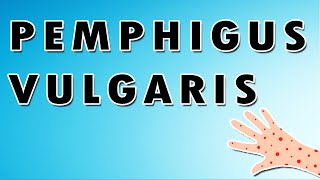 Pemphigus Vulgaris Symptoms Treatment and Causes [upl. by Bolling454]