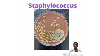 Things to know about Staphylococcus [upl. by Mainis]