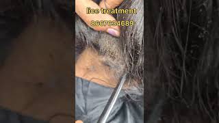 How to remove nits and lice treatment nits hair headlice haircare nitsremoval headliceremoval [upl. by Sandeep696]