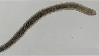 Para GIT  Hymenolepis Nana  Dwarf tape worm   الدودة القزمة [upl. by Tatia247]