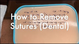 How to Remove Sutures Dental Suture Removal [upl. by Einahc]