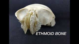 ETHMOID BONE [upl. by Iegres]