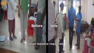 Motor Axonal Neuropathy Treatment Results  Quick Look  No 3084 [upl. by Middleton130]