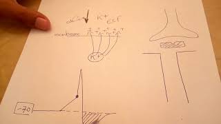 Case Familial Periodic Hypokalemic Paralysis [upl. by Alamaj]