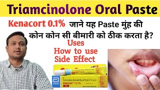 Kenacort 01  Kenacort gel how to use  Triamcinolone oromucosal paste bp 01 ww in hindi [upl. by Naor]