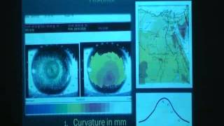 Corneal topography  DrMaged Maherwmv [upl. by Amahcen]