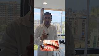 Teeth cleaning  at Dentist in Ulwe teethwhiteningteethcleaning teethplaque teeth [upl. by Philippine]