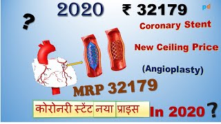 New Ceiling Price  What is CORONARY STENT  Types of Stent used in Angioplasty [upl. by Roseline]