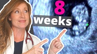 8 Week Ultrasound  PLUS how to Help with Morning Sickness [upl. by Hsivat]