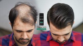 Hair Style For Very Thin amp Balding Hair by using Hair Fibers 2022 [upl. by Alegnasor418]