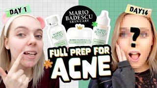 Honest Review 14 days WITH MARIO BADESCU Acne Repair Kit [upl. by Odilo]