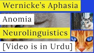 Wernickes Aphasia  Receptive Aphasia  Anomic Aphasia  Symptoms  Causes  Neurolinguistics [upl. by Nioe362]