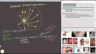 Generalized Seizure [upl. by Whitaker]