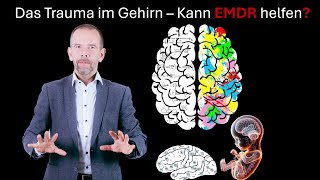 Das Trauma im Gehirn  Kann EMDR hier helfen [upl. by Ailehpo]