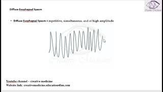 Lec 1 Diffuse Esophageal Spasm mp4 [upl. by Aidnyl]