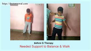 Leukodystrophy treatment  Dr Oswals G Therapy  Leucodistrofia Leukodystrophie حثل المادة البيضاء [upl. by Rus]