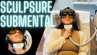 SCULPSURE SUBMENTAL CHIN PROCEDURE  FAT CONTOURING LASER [upl. by Luoar770]