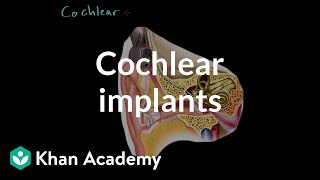 Cochlear implants  Processing the Environment  MCAT  Khan Academy [upl. by Anabelle]