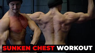 Back amp Chest Workout For Pectus Excavatum Treatment [upl. by Gennie]