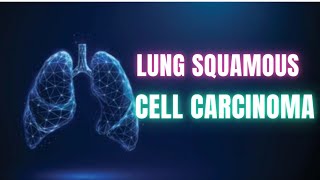 What is Lung Squamous Cell Carcinoma Overview and Insights  Dr Academy [upl. by Nylde]