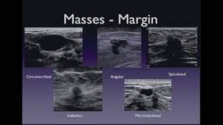 Ultrasound Imaging of the Breast – Lesion Characterization [upl. by Arola]