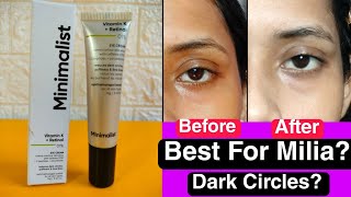 Minimalist 1 Retinol Under Eye Cream Review  BEST Retinol Under Eye Cream✅For MiliaDark circles [upl. by Nnyroc]