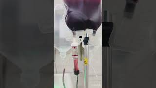 What are the benefits of blood blood transfusion dialysis shortvideo hemodiafiltration [upl. by Eceinej]