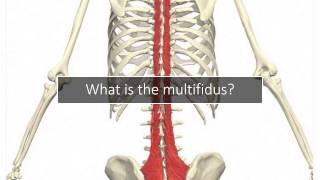 Multifidus Back Pain Why Your Doctor Never Discussed It [upl. by Esch727]