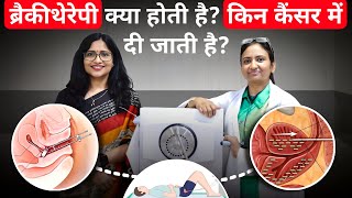 ब्रैकीथेरेपी क्या होती हैकिन कैंसर में दी जाती हैWhat is Brachytherapy Is Brachytherapy Painful [upl. by Tiduj]