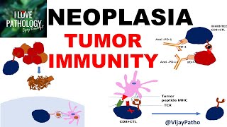 NEOPLASIA 9 TUMOR IMMUNITY tumor antigens Evasion of tumor immunity [upl. by Gaige]