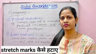 Striae Gravidarum  Stretch marks in pregnancy स्ट्रेच मार्क्स का बचाओ और इलाज [upl. by Ainoda]