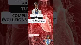 Guide pratique la péricardite aiguë Tutoriel essentiel pour les infirmiers ide tuto tip heart [upl. by Llertram]