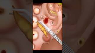 Asmr ear cleaning video  asmr ear cleaning video [upl. by Ydnar]