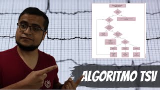 Taquicardia Supraventricular  Algoritmo Diagnóstico PerlasClínicas [upl. by Aimek]