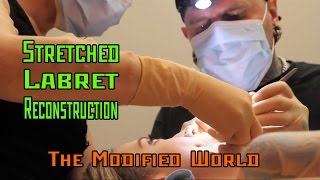 Stretched Labret Reconstruction  THE MODIFIED WORLD [upl. by Novad505]