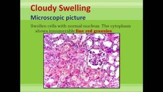 Cell Response to Injury 2nd pathology lecture [upl. by Constant]