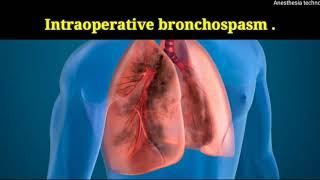 intraoperative bronchospasm [upl. by Emarie]