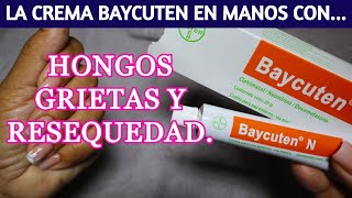 Cómo usar la CREMA BAYCUTEN en tus MANOS y cualquier AFECCION EN LA PIEL [upl. by Joris]