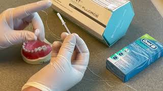 Proximal Curodont Repair Tutorial for Enamel Remineralization with Hydroxyapatite [upl. by Ellened]