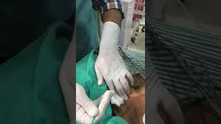 Central line Insertion Internal Jugular Vein [upl. by Ihn]