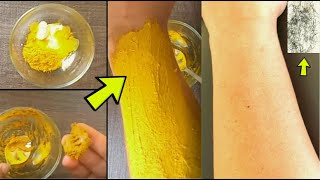 Remove Unwanted Hair Permanently at Home  DIY Unwanted Hair Removal for Women Naturally [upl. by Mello815]