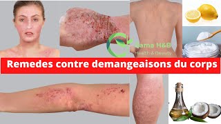 COMMENT CALMER LES DÉMANGEAISONS DU CORPS  Rama Health amp Beauty [upl. by Acey]